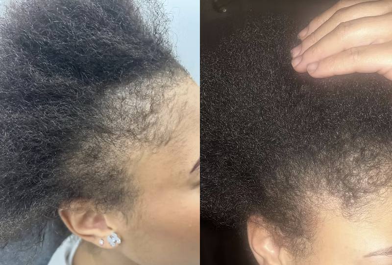 L'ELIXIR - Sérum de croissance